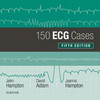 Produktbild: 150 ECG Cases