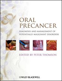 Produktbild: Oral Precancer