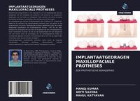 Produktbild: Implantaatgedragen Maxillofaciale Protheses