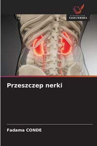 Produktbild: Przeszczep nerki