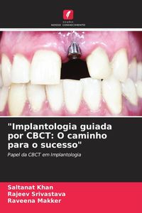 Produktbild: Khan, S: "Implantologia guiada por CBCT