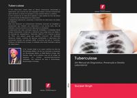 Produktbild: Tuberculose