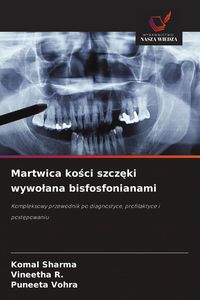 Produktbild: Martwica ko&iquest;ci szcz&iquest;ki wywo&iquest;ana bisfosfonianami