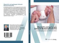 Produktbild: &Uuml;bersicht und geh&auml;ngte Zickzack-Beckenosteotomie