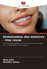 Produktbild: Distalization des molaires - Une revue
