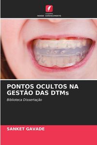 Produktbild: Pontos Ocultos Na Gest&atilde;o das Dtms