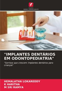 Produktbild: "implantes Dent&aacute;rios Em Odontopediatria"