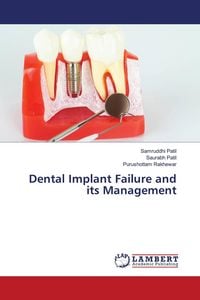 Produktbild: Dental Implant Failure and its Management