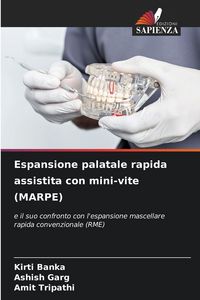 Produktbild: Espansione palatale rapida assistita con mini-vite (MARPE)