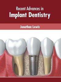 Produktbild: Recent Advances in Implant Dentistry