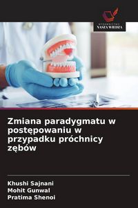 Produktbild: Zmiana paradygmatu w post&iquest;powaniu w przypadku pr&oacute;chnicy z&iquest;b&oacute;w