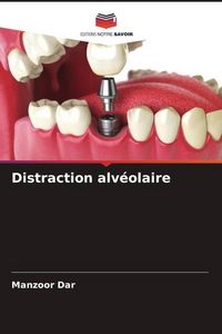 Produktbild: Distraction alv&eacute;olaire