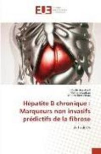 Produktbild: H&eacute;patite B chronique : Marqueurs non invasifs pr&eacute;dictifs de la fibrose