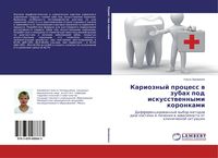 Produktbild: Karioznyj process w zubah pod iskusstwennymi koronkami