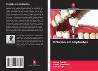 Produktbild: Oclus&atilde;o em implantes
