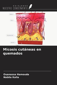 Produktbild: Micosis cut&aacute;neas en quemados