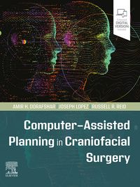 Produktbild: Computer-Assisted Planning in Craniofacial Surgery - E-Book