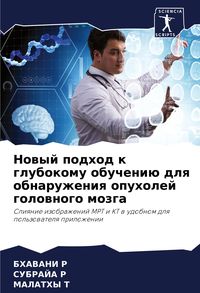 Produktbild: Nowyj podhod k glubokomu obucheni&uuml; dlq obnaruzheniq opuholej golownogo mozga