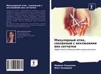 Produktbild: Makulqrnyj otek, swqzannyj s okkl&uuml;ziqmi wen setchatki