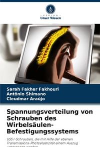 Produktbild: Spannungsverteilung von Schrauben des Wirbels&auml;ulen-Befestigungssystems