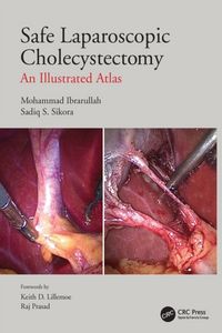 Produktbild: Ibrarullah, M: Safe Laparoscopic Cholecystectomy