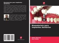 Produktbild: Biomateriais para implantes dent&aacute;rios
