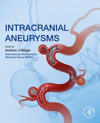 Produktbild: Intracranial Aneurysms