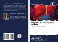 Produktbild: Opuholi i metastazy w pecheni