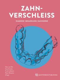 Produktbild: Zahnverschlei&szlig;