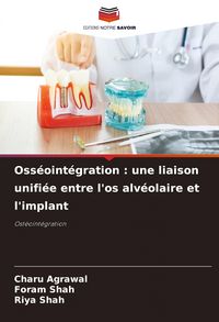 Produktbild: Oss&eacute;oint&eacute;gration : une liaison unifi&eacute;e entre l'os alv&eacute;olaire et l'implant