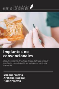 Produktbild: Implantes no convencionales