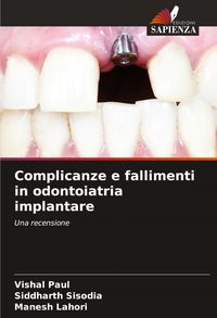 Produktbild: Complicanze e fallimenti in odontoiatria implantare
