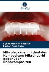 Produktbild: Mikroleckagen in dentalen Kompositen: Mikrohybrid gegen&uuml;ber Nanokompositen
