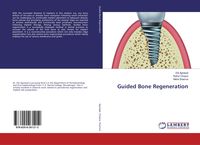 Produktbild: Guided Bone Regeneration