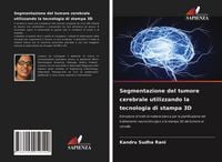 Produktbild: Segmentazione del tumore cerebrale utilizzando la tecnologia di stampa 3D