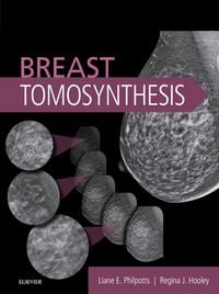 Produktbild: Breast Tomosynthesis E-Book