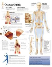 Produktbild: Understanding Osteoarthritis C