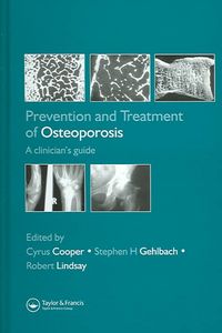 Produktbild: Prevention and Treatment of Osteoporosis in the High-Risk Patient