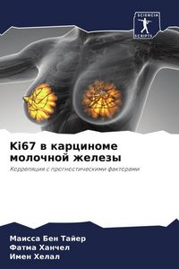 Produktbild: Ki67 w karcinome molochnoj zhelezy