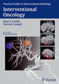 Produktbild: Interventional Oncology