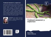 Produktbild: Gnojnyj meningit u wzroslyh