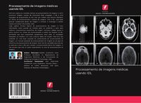 Produktbild: Processamento de imagens m&eacute;dicas usando IDL