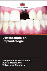 Produktbild: L'esth&eacute;tique en implantologie