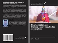 Produktbild: Neumonectom&iacute;as: indicaciones y resultados quir&uacute;rgicos