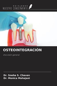 Produktbild: Osteointegraci&oacute;n