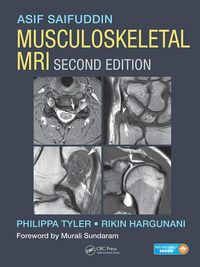 Produktbild: Musculoskeletal MRI