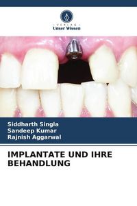 Produktbild: Implantate und Ihre Behandlung