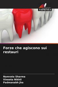Produktbild: Forze che agiscono sui restauri