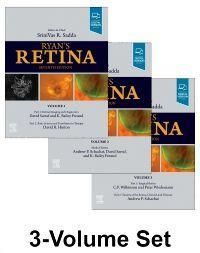 Produktbild: Ryan's Retina