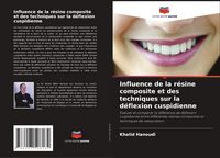 Produktbild: Influence de la r&eacute;sine composite et des techniques sur la d&eacute;flexion cuspidienne